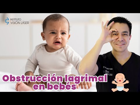 Obstrucción lagrimal en bebés