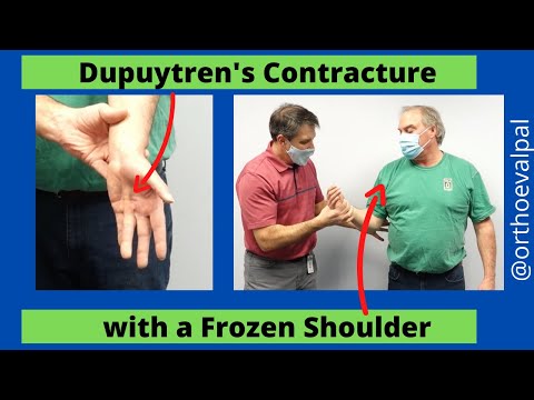 Shoulder Apprehension Test and Relocation Test