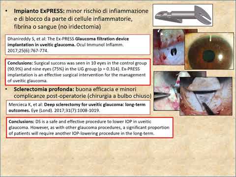 Congresso  - Trattamento Medico e Chirurgico del Glaucoma Uveitico