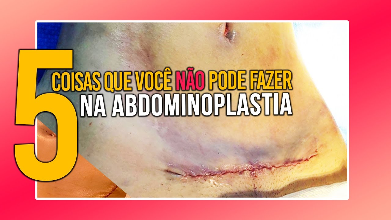 5 COISAS QUE VOCÊ NAO PODE FAZER NA ABDOMINOPLASTIA - CIRURGIA PLÁSTICA