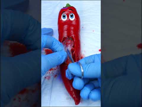 , title : 'Pepper needs surgical operation  Birth of a baby #shorts'