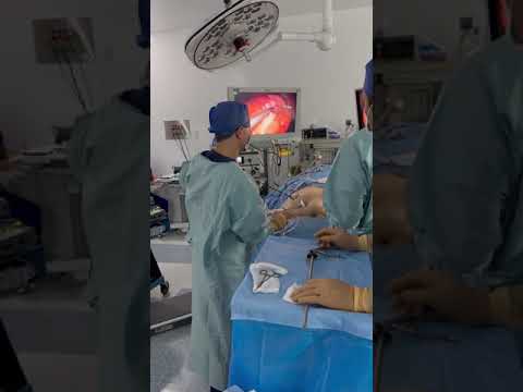Laparoscopic Surgery in the Operating Room: Minimally Invasive Demo