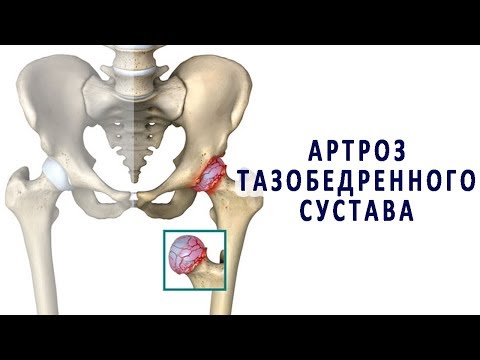 Болит шея при наклоне головы назад Остеохондроз в шейном отделе упражнения