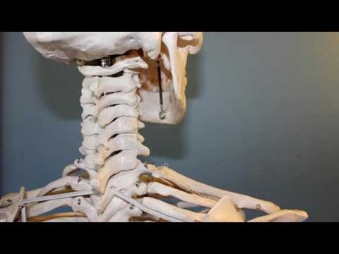 Artrosi deformante È il caffè cattivo osteocondrosi