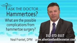 preview picture of video 'What Are The Complications From Hammertoe Surgery? Chicago, Oak Brook, Lincolnwood, IL - Podiatrist'