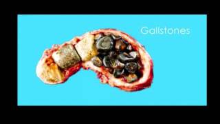 How to Cure your Liver, Gallbladder & Stones - Easy Detox Instant Cleanse!