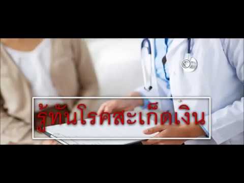 รักษากลากในอิสราเอลที่ทะเลเดดซี โรคผิวหนังภูมิแพ้ Nizoral