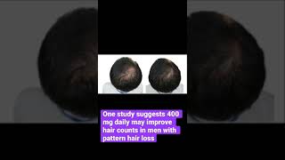 Download lagu Pumpkin seed oil for hair growth #shorts mp3 Download lagu Pumpkin seed oil for hair growth #shorts mp3