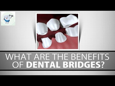 Immediate Denture
