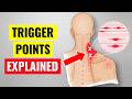 What Science ACTUALLY Says About Trigger Points Myofascial Pain
