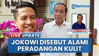 Ajudan Ungkap Jokowi Alami Peradangan Kulit akibat Alergi, Kondisinya Kini Dilaporkan Sudah Membaik