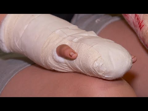 Info - Petarde sve opasnije (TV KCN 27.12.2025)