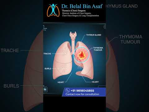 Thymoma & Myasthenia Gravis: Warning Signs You Should Never Ignore. #medical #short #thymoma