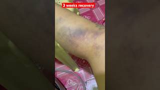 Download lagu Re aplod due block music copyright before #subscribe #shorts mp3 Download lagu Re aplod due block music copyright before #subscribe #shorts mp3