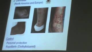 Dr Azza   Arthropods 3   Mites   YouTube