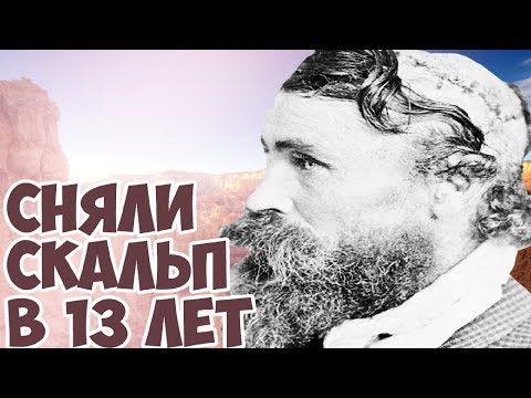 ОН СМОГ ВЫЖИТЬ ПОСЛЕ СКАЛЬПИРОВАНИЯ!