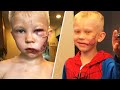 Boy Who Saved Sister In Dog Attack Gets Call From Spider Man