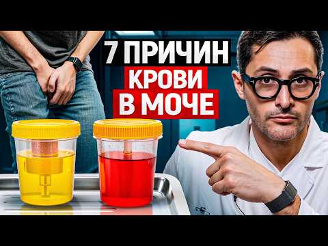 Кровь в моче. 7 причин от безобидных до смертельно опасных
