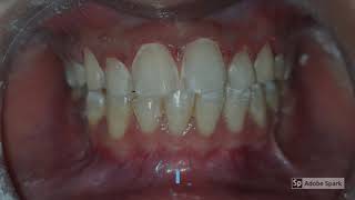 Best Cosmetic Dentist In Udaipur (Rajasthan)