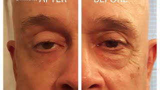 3 minute instant facelift serum