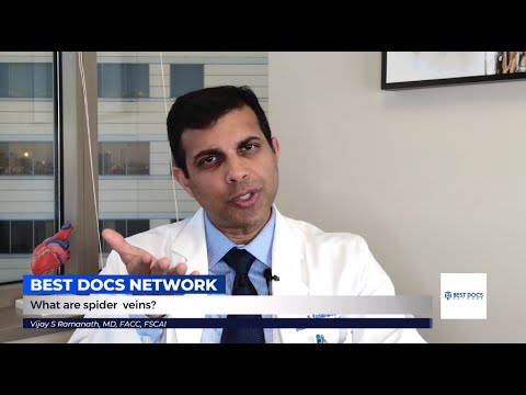 Spider Vein Treatment: What You Need to Know
