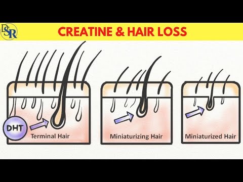 👉 Creatine & Hair Loss - Real Scientific TRUTH!