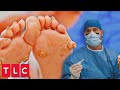 Horns Growing From Her Feet (Full Surgery) | My Feet Are Killing Me
