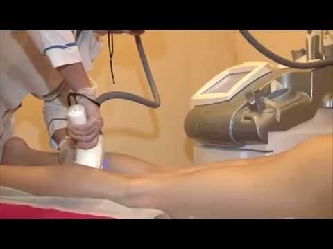 Лазерная эпиляция волос 