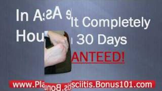 preview picture of video 'cure for plantar fasciitis - plantar fasciitis relief - cure plantar fasciitis'