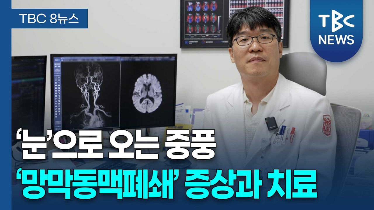 눈으로 온 중풍 '망막동맥폐쇄' ㅣ 신경과 홍정호 교수 관련사진