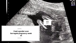 Surrogate Pregnancy week 15! GENDER SCAN!!!#SurrogacySunday