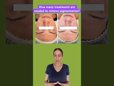 How to get rid of dark spots on face?