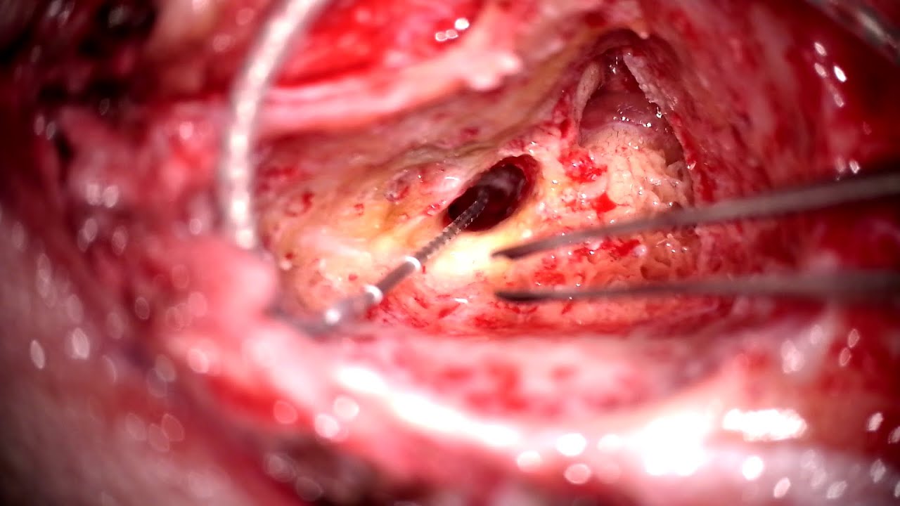 Rubén Polo López-13