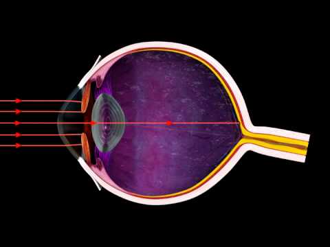 How the Iris Controls Light Entering the Eye - 3D Medical Animation Eye || ABP ©