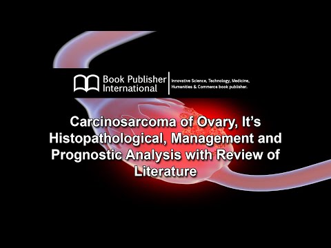 Carcinosarcoma of Ovary, It’s Histopathological, Management and Prognostic Analysis with Review