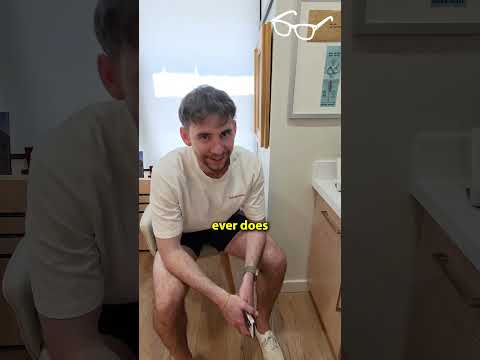 His 12 Month Post-Op Hair Transplant Result Is INCREDIBLE!