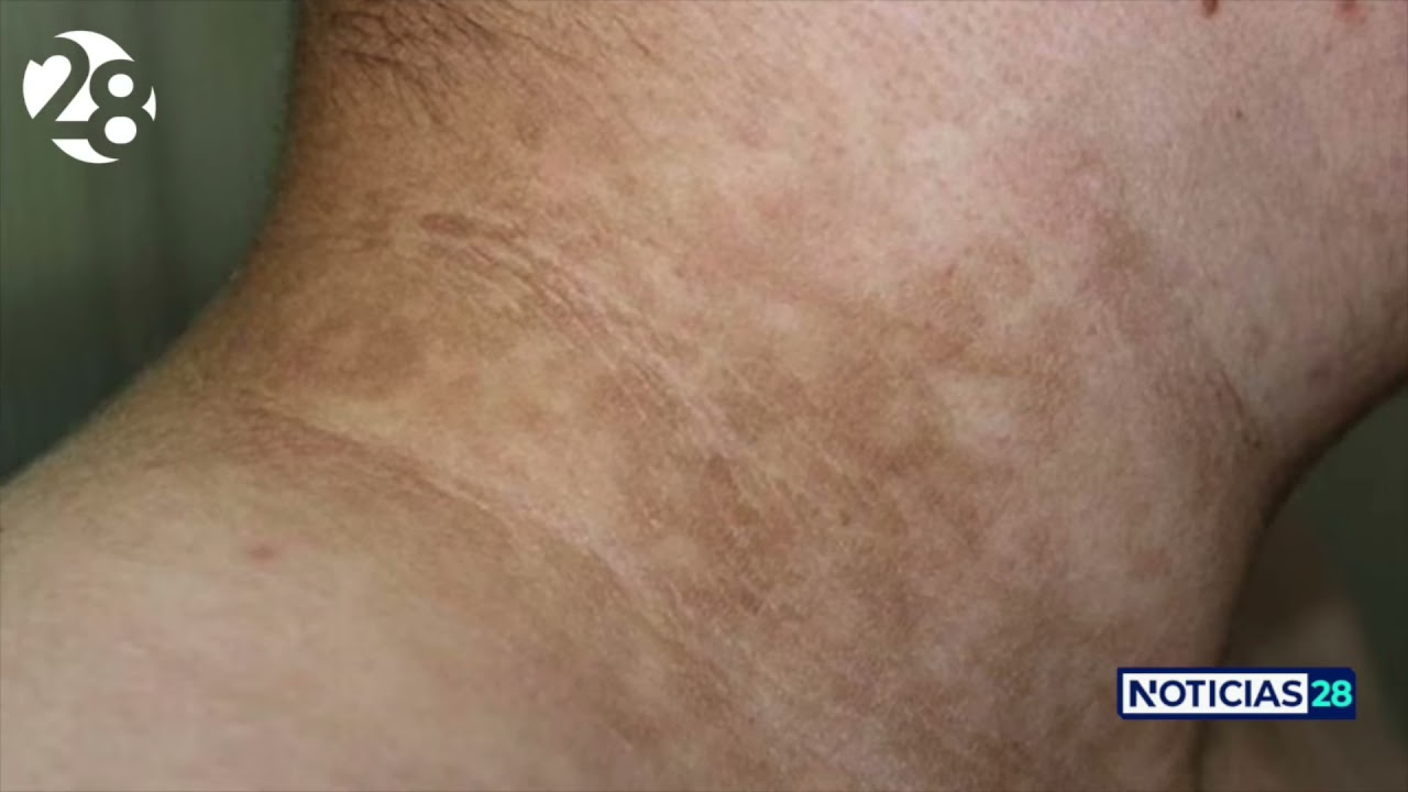 Francisco Ariel Navarrete Acosta-56