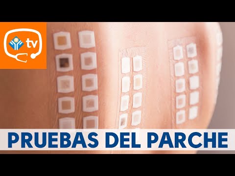 ¿Qué son las pruebas del parche?