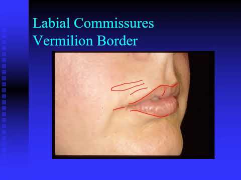 1c. Introduction to the Oral Cavity, Oral Examination Exercise