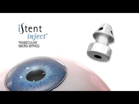 Glaukom - Grüner Star Eingriff iStent inject Animation