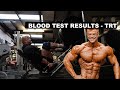 Full Blood Test Results, 20 weeks TRT (Before blast)