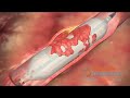 5th International Conference on Cardiology and Cardiac Surgery