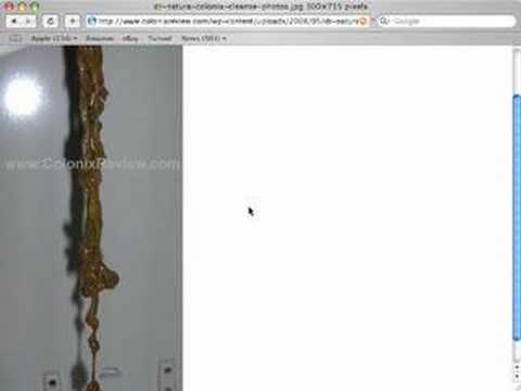 Colonix Colon Cleansing Program Review - Day 36