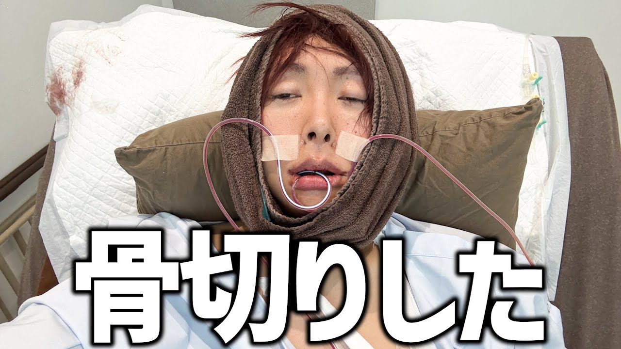 骨切りダウンタイム密着