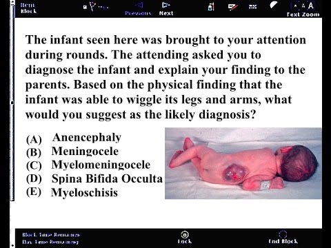 download lagu mp3 mp4 Usmle Questions, download lagu Usmle Questions gratis, unduh video klip Download Usmle Questions Mp3 dan Mp4 Unlimited Gratis