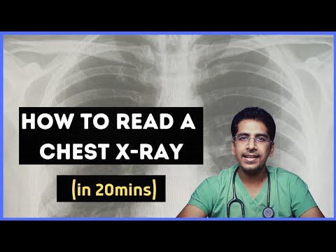 How to read a chest X-ray (in 20 mins) !