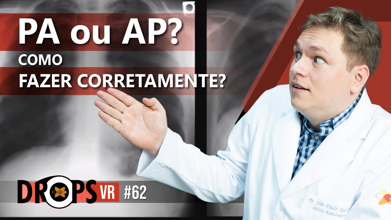 IDENTIFICANDO UMA RADIOGRAFIA DO TÓRAX BEM FEITA