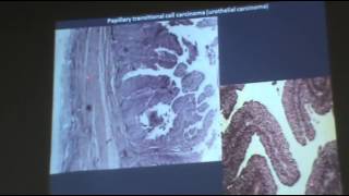 Dr.Ahmed seleman - pathology-  urinary bladder