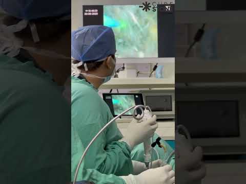 Life of a Surgeon | How kidney stones are removed | rirs #kidneyday #renalcare