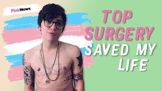 Ryan Cassata: Top surgery scars and recovery